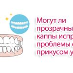 Могут ли прозрачные каппы исправить проблемы с прикусом у детей?