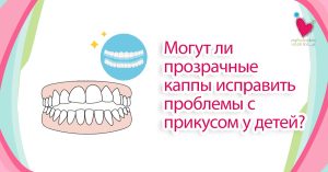 Могут ли прозрачные каппы исправить проблемы с прикусом у детей?