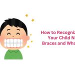 How to Recognize When Your Child Needs Braces and What to Do